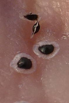 Spergularia flaccida